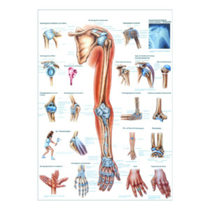 Anatomical Chart "Upper Limb"