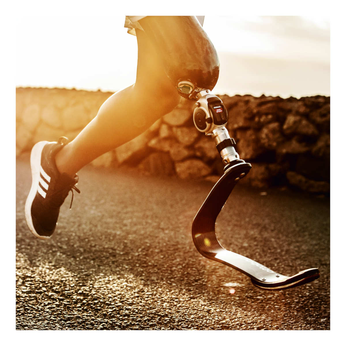 Runner | Fitness Prosthetics | Lower Limb Prosthetics | Prosthetics ...