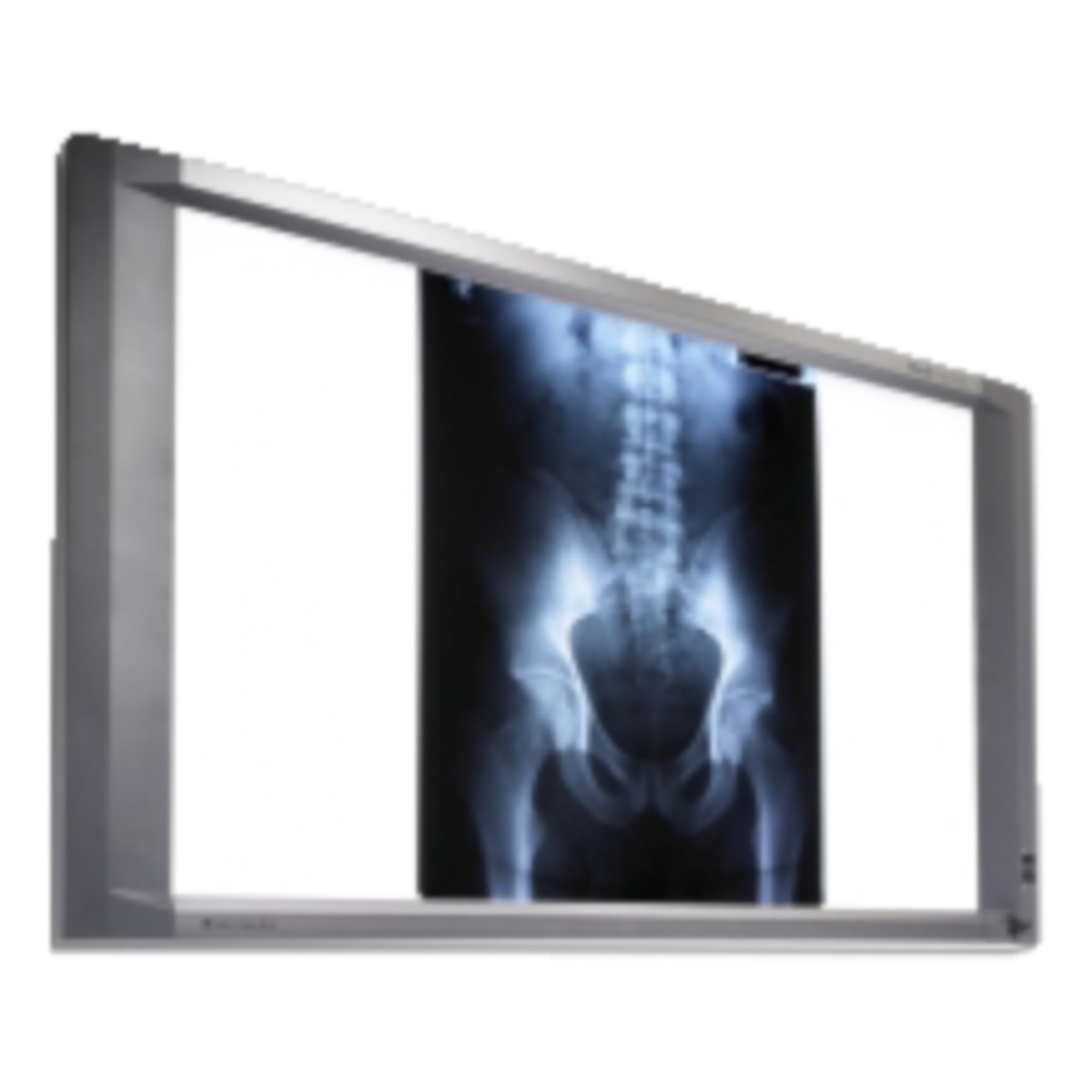 X-Ray Light Cabinet | Ottobock